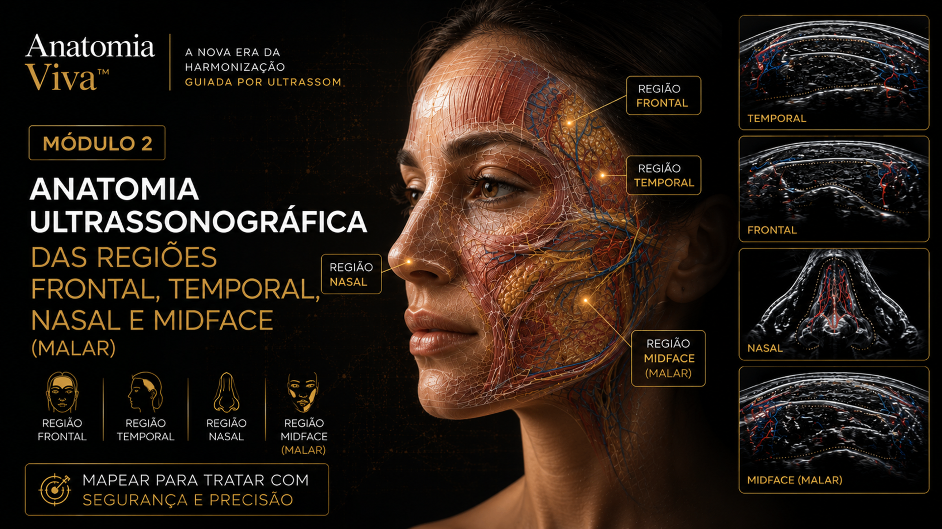 Módulo 2 — Anatomia Ultrassonográfica: transdutor L18-5 sobre o dorso nasal com imagem anotada (pele, tecido subcutâneo, SMAS, músculo nasal, cartilagem lateral e osso nasal).
