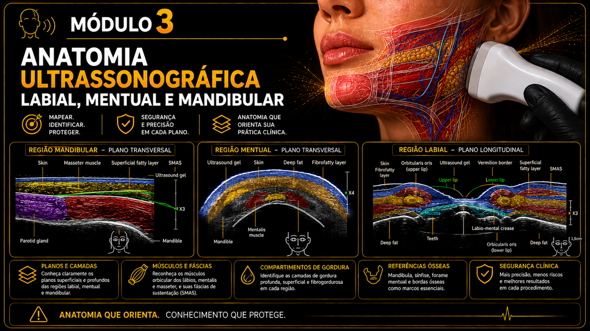 Módulo 3 — Anatomia Ultrassonográfica Parte 2: transdutor L18-5 sobre a mandíbula com imagem anotada (pele, tecido subcutâneo, SMAS, músculo masseter, periósteo e osso mandibular).