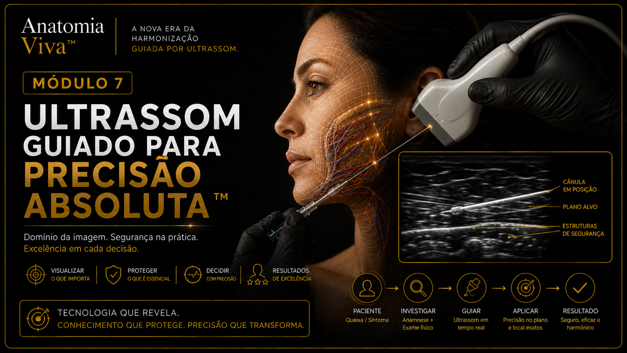 Módulo 7 — Ultrassom Guiado: transdutor L18-5 sobre a face acompanhando cânula em tempo real, com imagem anotada mostrando pele, tecido subcutâneo, cânula hiperecogênica, plano alvo e músculo.
