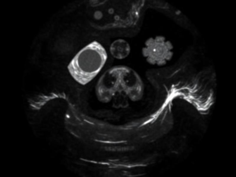 Nódulos e granulomas